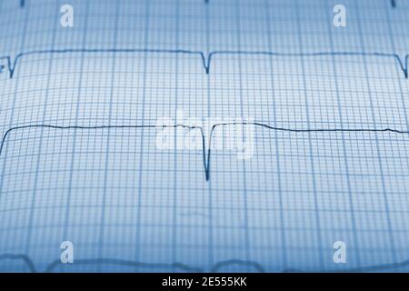 Seismic activity register lines close-up. Stock Photo