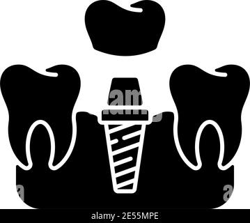 Dental implants procedure black glyph icon Stock Vector