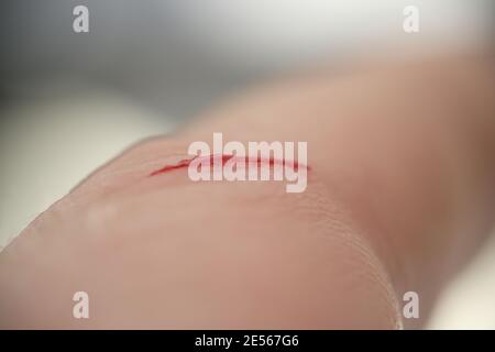 Cut with blood on the skin closeup Stock Photo