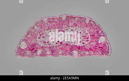 Scots pine (Pinus sylvestris) leaf. Light micrograph of a section ...