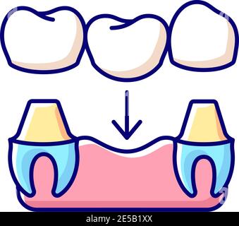Dental prosthetics RGB color icon Stock Vector