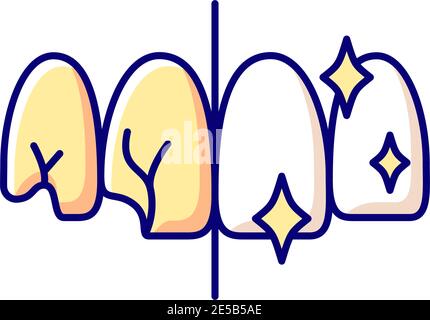 Tooth restoration RGB color icon Stock Vector