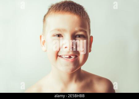 Pediatric dentistry concept. Cute emotional boy without a tooth. Stock Photo