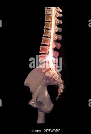 CT Lumbar spine or L-S spine 3D rendering image sagittal view 3D rendering  . Stock Photo
