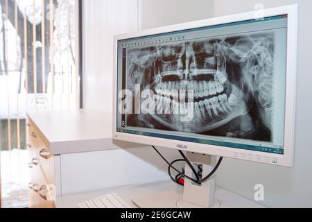 2021 01 28. Panoramic Dental Xray. Stock Photo