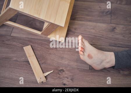 Woman injured foot on leg after falling from wooden stepladder. The problem with labor protection at diy work at home Stock Photo