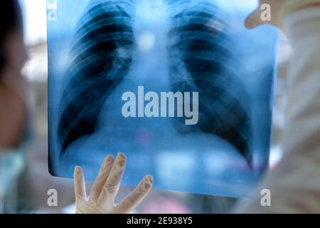 A female pneumologist holds a lung scan in her hands. Stock Photo