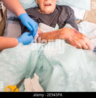 The ninety five year old has the injured arm bandaged at his house by a visiting district nurse.He is unable to leave his bed or house due to frailty Stock Photo