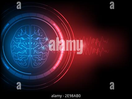 Concepts of focal seizure. Illustration of human epileptic brain and abnormal electroencephalography or EEG wave discharges Stock Vector