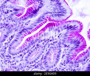 Gastric mucosa where the intense PAS positivity of the epithelium lining the inner surface of the stomach and the gastric pits is observed. Stock Photo