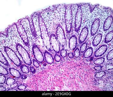 Lieberkühn crypts of a human colon mucosa showing abundant goblet cells of pale cytoplasm.