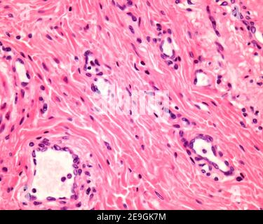 Blood vessels in connective tissue, light micrograph Stock Photo - Alamy