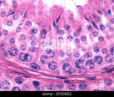 High magnification micrograph of a seminiferous tubule. The germinal ...