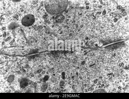 Transmission electron microscope (TEM) micrograph showing three desmosomes (maculae adherentes) with prominent dense plaques where keratin intermediat Stock Photo