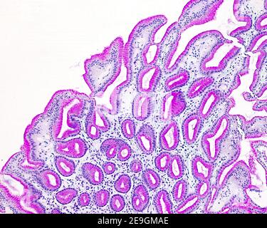 Surface epithelium lining the gastric mucosa showing an intense staining with the PAS technique. The oval profiles below are sections of the gastric p Stock Photo