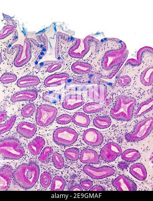 Goblet cells (blue) in the lining epithelium of the gastric mucosa ...