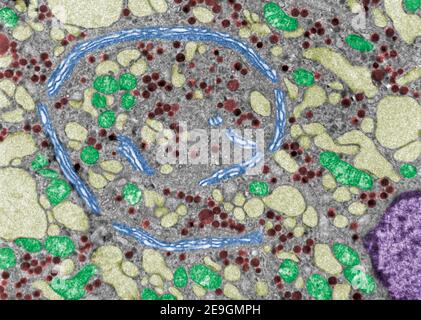 False colour electron microscope micrograph showing the Golgi apparatus (blue), mitochondria (green), very dilated RER cisterns (pale yellow) and secr