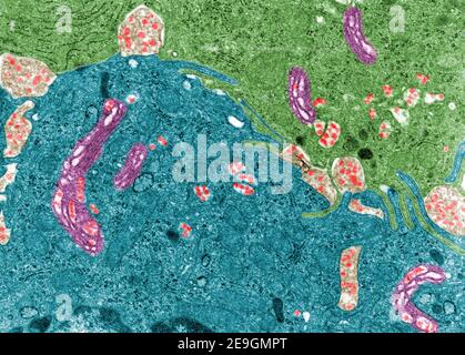 False colour transmission electron microscope (TEM) micrograph showing chylomicrons (red) in enterocytes of small intestine. They appear in the Golgi