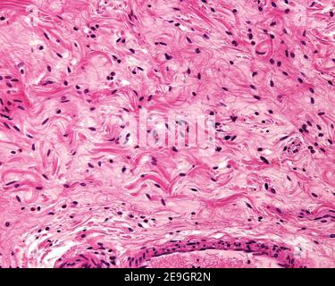 Example of a typical loose connective tissue belonging to the submucosa of the stomach. Collagen appear as isolated fibers and wavy bundles of fibers. Stock Photo