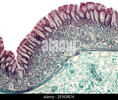 Light micrograph of the gastric mucosa stained with the Periodic acid ...