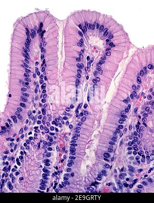 Simple columnar epithelium, light micrograph Stock Photo - Alamy