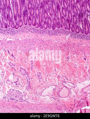 Mucosa layer of the large intestine with Lieberkühn crypts, lined with ...