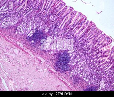 Gastric mucosa. Pyloric antrum showing: the great depth of the gastric ...