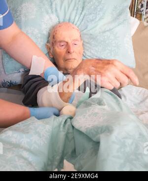 The ninety five year old has the injured arm bandaged at his house by a visiting district nurse.He is unable to leave his bed or house due to frailty Stock Photo