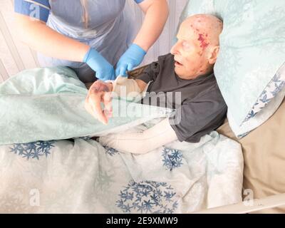 The ninety five year old has the injured arm bandaged at his house by a visiting district nurse.He is unable to leave his bed or house due to frailty Stock Photo