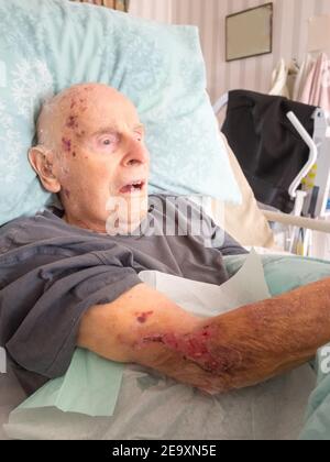 The ninety five year old has the injured arm bandaged at his house by a visiting district nurse.He is unable to leave his bed or house due to frailty Stock Photo