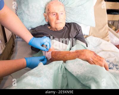 The ninety five year old has the injured arm bandaged at his house by a visiting district nurse.He is unable to leave his bed or house due to frailty Stock Photo