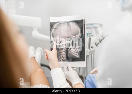 Dentist showing x-ray of a skull for young patient Stock Photo