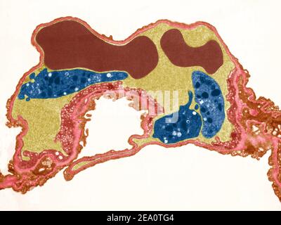 Lung capillary, TEM Stock Photo