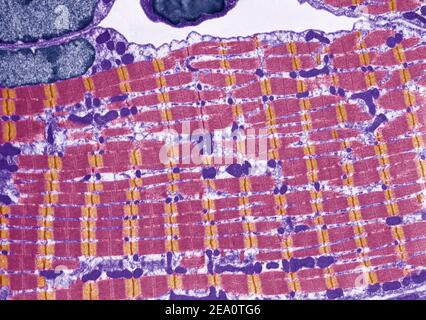 Striated muscle, TEM Stock Photo