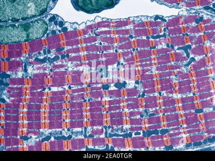 Striated muscle, TEM Stock Photo