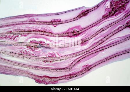 Egg of the liver fluke Stock Photo - Alamy