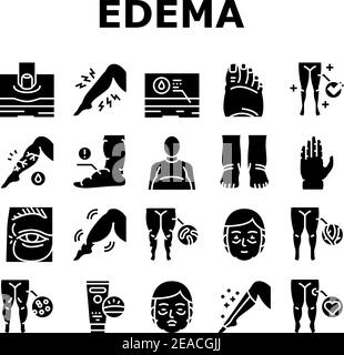 Edema Disease Symptom Collection Icons Set Vector Stock Vector