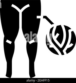 lymphatic edema glyph icon vector illustration Stock Vector