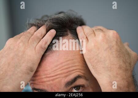 Man Checking His Hair Loss Stock Photo