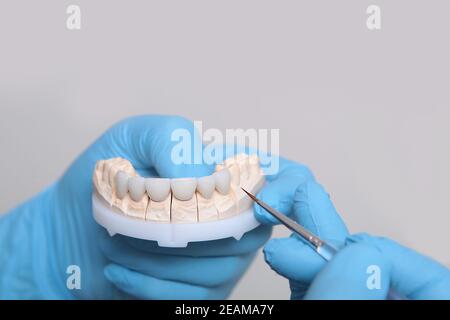 A dental technician holds a mock-up of teeth and veneers in his hands. Hands in protective gloves. The concept of beauty or health. Unrecognizable person. Stock Photo