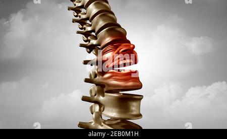 Spine pain and spinal ache or bachache medical disease symbol as a suffering human skeleton screa. icon as Stock Photo