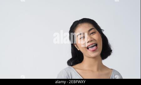 Oral Care. Dental brace teenager girl smile and looking to camera. white teeth with blue braces. Dental care. Asian woman with contact lens and orthod Stock Photo