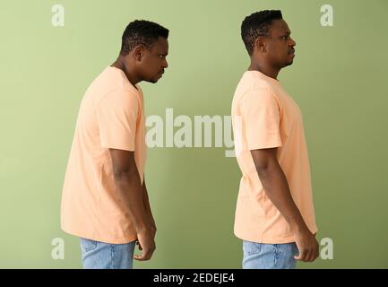 Young man with bad and proper posture on color background Stock