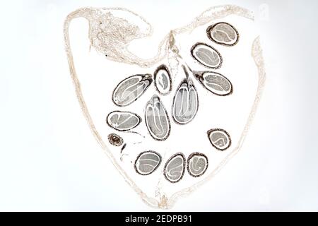 Shepherd's-purse (Capsella bursa-pastoris), longitudinals cut of the fruit, with seeds and their embryos, microtome section, Europe Stock Photo