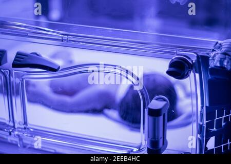 Newborn baby under ultraviolet lamp is getting treated for jaundice (elevated bilirubin) in Vancouver hospital Stock Photo