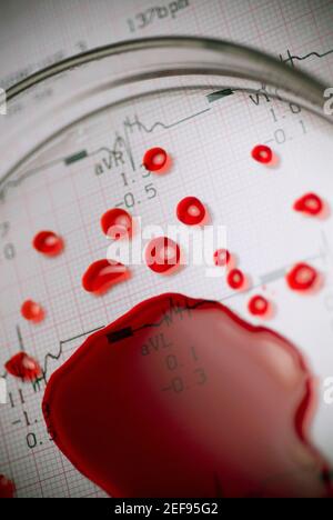 Close up of a magnifying glass on blood cells Stock Photo