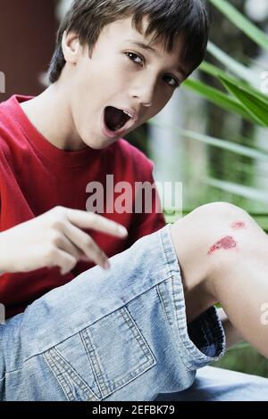 Portrait of a boy with wounds on his knee Stock Photo