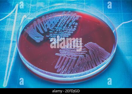 Petri plate with bacteria Steptococcus Phaemolifticus G, Streptococcus Agalactiae, Streptococcus Phaemolifticus Stock Photo
