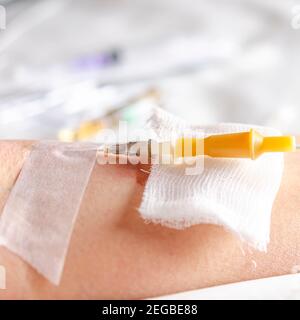 Medicine. Intravenous injection. The drip is intravenous. First aid ...
