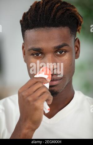 young man recovering healing at home after plastic surgery nose Stock Photo